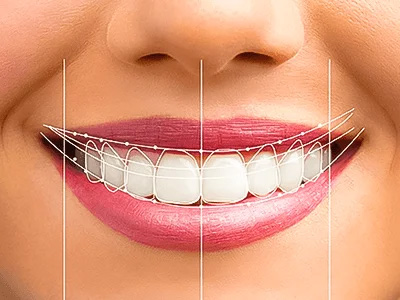 Bite-It smile analysis visualization showing unified dental assessment